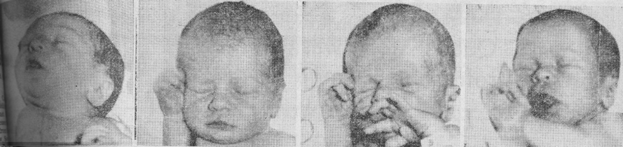 JWB 1962_Becker quadruplets